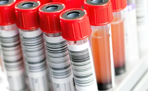 實驗室藥品試劑管理應(yīng)用方針